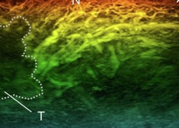 New miniature scanner could revolutionise diagnosis of diseases like cancer, diabetes and arthritis | Science & Tech News