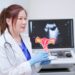 Simple tweak to cervical cancer treatment cuts risk of death by 40%, say researchers | Science & Tech News