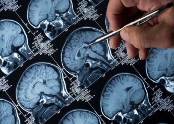 Pioneering Alzheimer’s drug rejected for widespread use in NHS in England | UK News