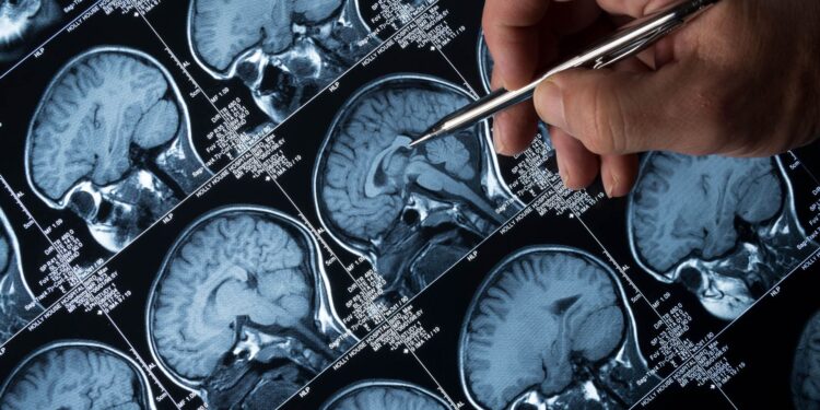 Pioneering Alzheimer’s drug rejected for widespread use in NHS in England | UK News