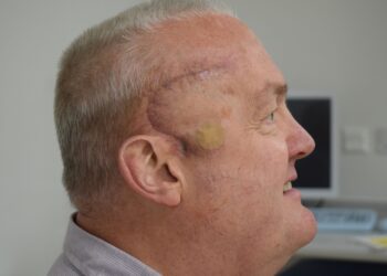 New cancer treatment trial shrinks Luton man’s brain tumour by half after just weeks of radioactive injections | UK News