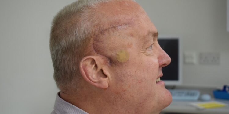 New cancer treatment trial shrinks Luton man’s brain tumour by half after just weeks of radioactive injections | UK News