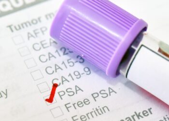 Prostate cancer test shown to ‘reduce number of deaths’ – as charity calls for change | Science & Tech News