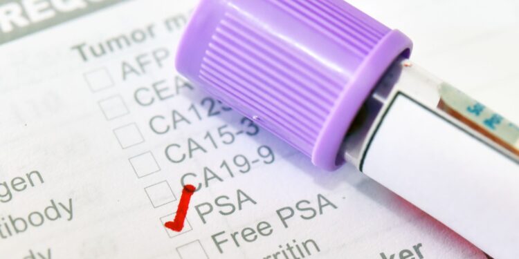 Prostate cancer test shown to ‘reduce number of deaths’ – as charity calls for change | Science & Tech News